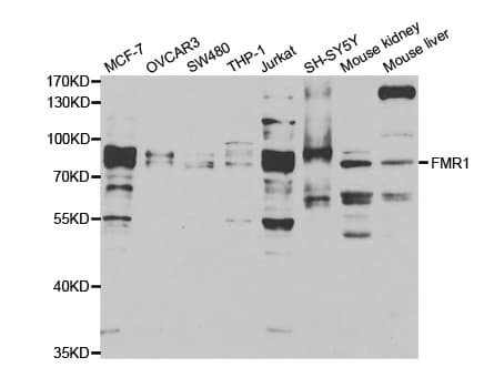 Polyclonal Rabbit anti-Human FMR1 / FMRP Antibody (IHC, IF, WB)