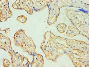 Polyclonal Rabbit anti-Human SOAT1 Antibody (aa1-130, IHC, WB)