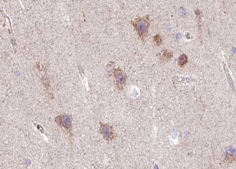 GRIA2 / GLUR2 Antibody (phospho-Ser880)