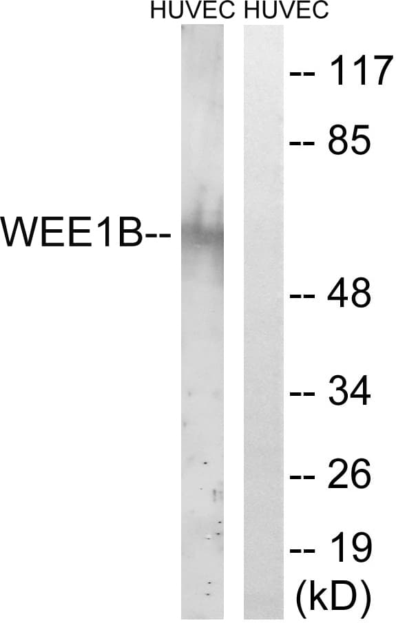 WEE1B / WEE2 Antibody (aa151-200)