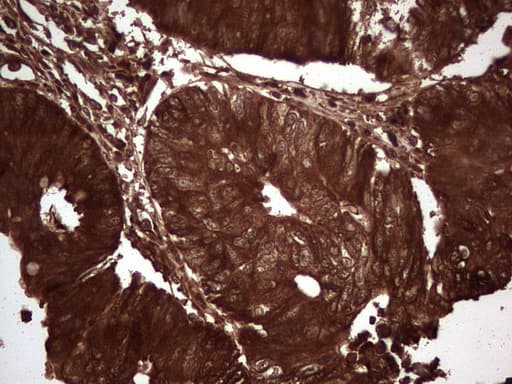 LGALS3 / Galectin 3 Antibody (clone OTI2F1)