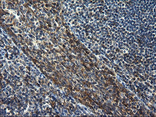 GCLC Antibody (clone OTI1A3)