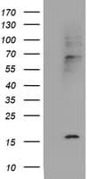 Cystatin SA / CST2 Antibody (clone OTI1D6)