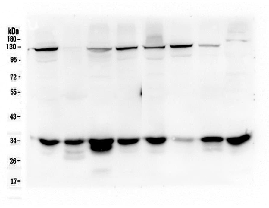 PRKAB2 / AMPK Beta 2 Antibody