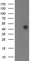 TMOD1 / Tropomodulin 1 Antibody (clone OTI1H10)