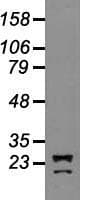 NEUROG1 / NGN1 / Neurogenin 1 Antibody (clone OTI3F9)