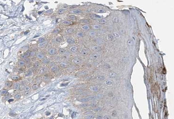 VASP Antibody (phospho-Ser157)