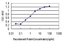 PathPlus™ FOXA1 Antibody (clone 2D7)