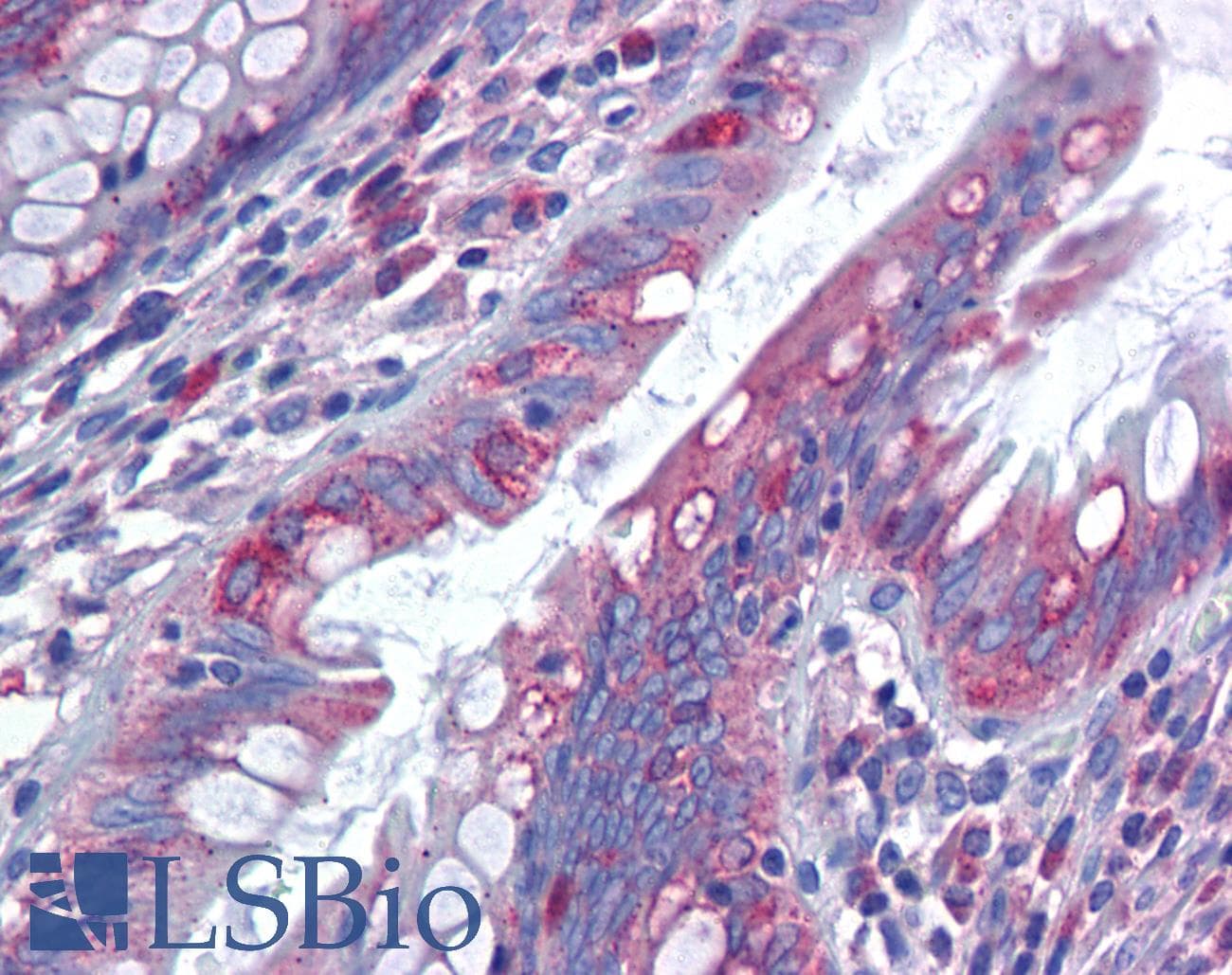 IHC-plus™ Polyclonal Rabbit anti-Human MUC13 Antibody (aa421-470, IHC, IF, WB)