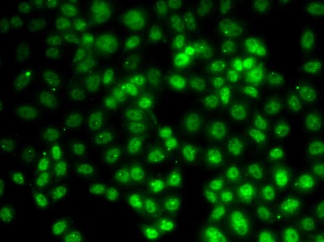 PRMT2 Antibody
