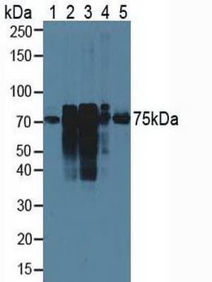 CTTN / Cortactin Antibody (aa1-509)