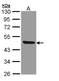 Polyclonal Rabbit anti-Human CD121b / IL1R2 Antibody (aa172-398, IHC, WB)