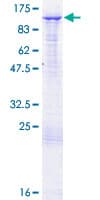 Human BAP1 Protein (Recombinant GST)