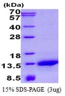 Human NDUFA2 Protein (Recombinant His)