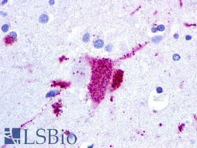 PathPlus™ Polyclonal Rabbit anti-Human CHEMR23 / CMKLR1 Antibody (N-Terminus, IHC)