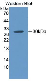 CD38 Antibody (aa53-284)