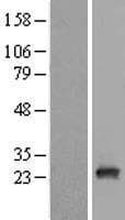 RAB9B Protein (Over-Expression Lysate Myc-DDK (Flag))