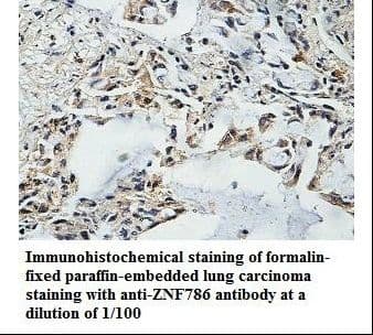 ZNF786 Antibody (aa277-544)