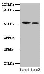RPS6KB2 / S6K2 Antibody