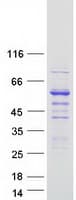 Human SNTB2 Protein (Recombinant Myc-DDK (Flag))