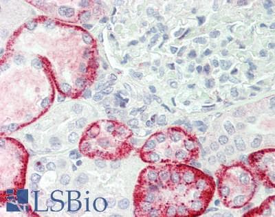 IHC-plus™ Polyclonal Rabbit anti-Human CD1D Antibody (Internal, IHC, WB)