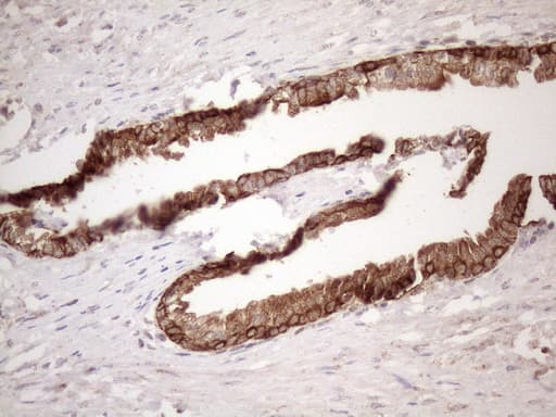 Vps60 / CHMP5 Antibody (clone OTI2E6)