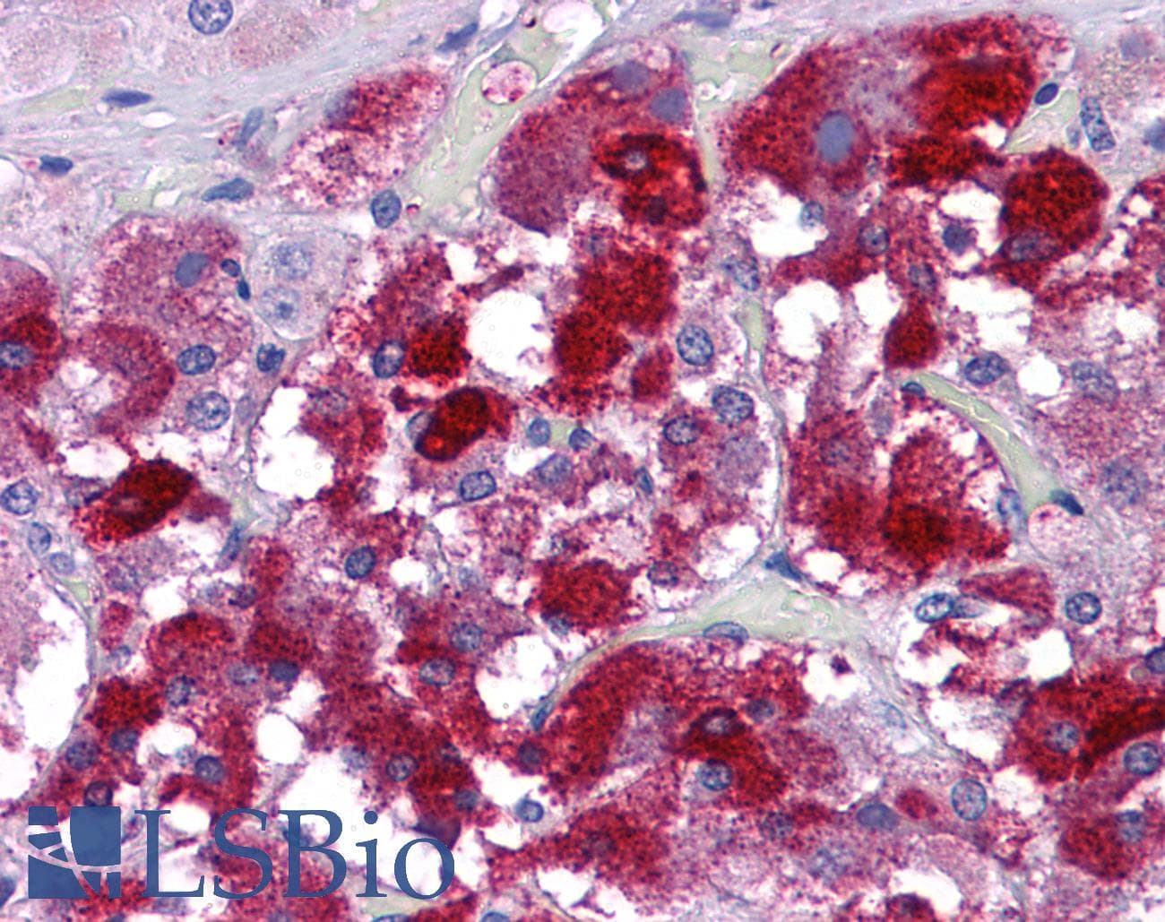 IHC-plus™ Polyclonal Rabbit anti-Human MFSD1 Antibody (IHC, WB)