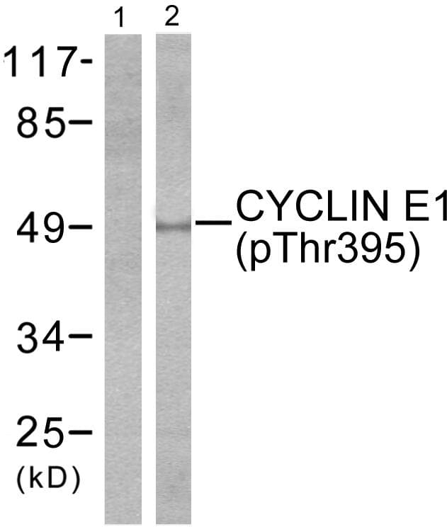 CCNE1 / Cyclin E1 Antibody (phospho-Thr395)
