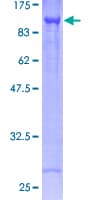 Human CARS1 / CARS Protein (Recombinant GST)