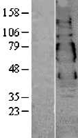 VSIG1 Protein (Over-Expression Lysate Myc-DDK (Flag))