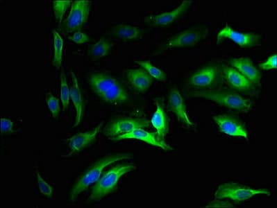 SLC25A26 Antibody