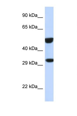 ETS2 Antibody (aa311-360)