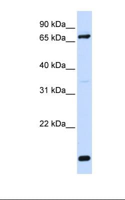 Polyclonal Rabbit anti-Human ACSL4 / FACL4 Antibody (N-Terminus, IHC, WB)