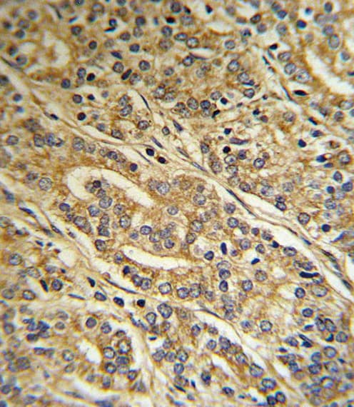 Polyclonal Rabbit anti-Human ACOT8 Antibody (aa290-319, IHC, WB)