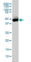 IHC-plus™ Monoclonal Mouse anti-Human CTBP1 / CTBP Antibody (clone 2G7, IHC, IF, WB)