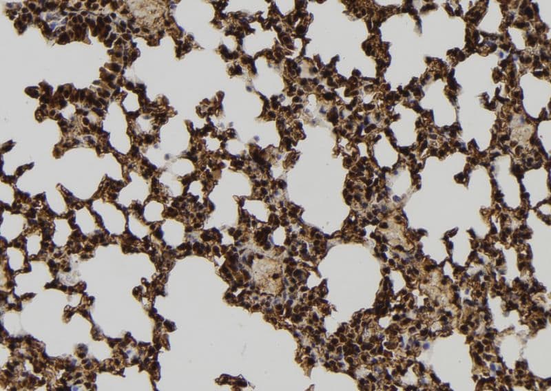 Polyclonal Rabbit anti-Human GPATC8 Antibody (IHC, WB)