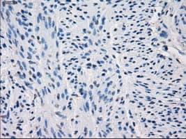 Monoclonal Mouse anti-Human GBP2 Antibody (clone OTI1E5, IHC, IF, WB)