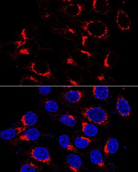 Polyclonal Rabbit anti-Human US01 / p115 Antibody (IF, WB)