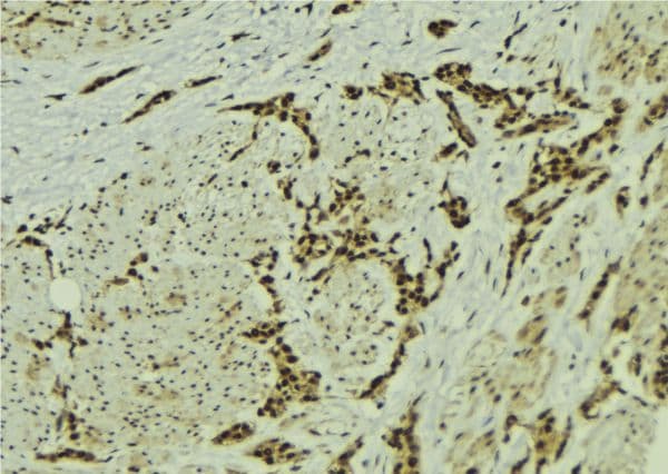 MMS19 Antibody