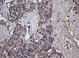 CRYAA / Alpha A Crystallin Antibody (clone OTI2C3)