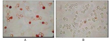 HHV-8 ORF62 Antibody (clone 5B7B6)