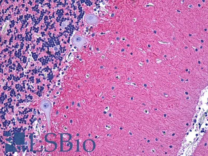 IHC-plus™ Monoclonal Mouse anti-Human NCAM / CD56 Antibody (clone 123C3, Concentrated, IHC, IF)