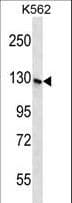 SH3TC1 Antibody (aa1026-1055)