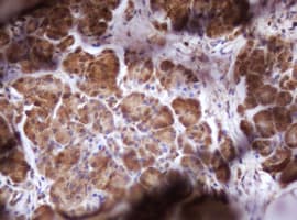 IDH1 / IDH Antibody (clone OTI1D1)