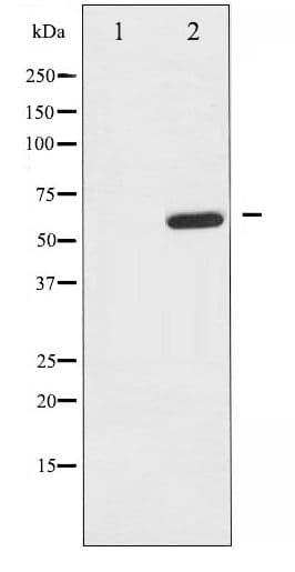 PDPK1 / PDK1 Antibody (phospho-Ser241)