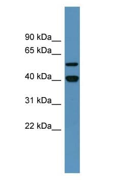 DDB2 Antibody (aa351-400)