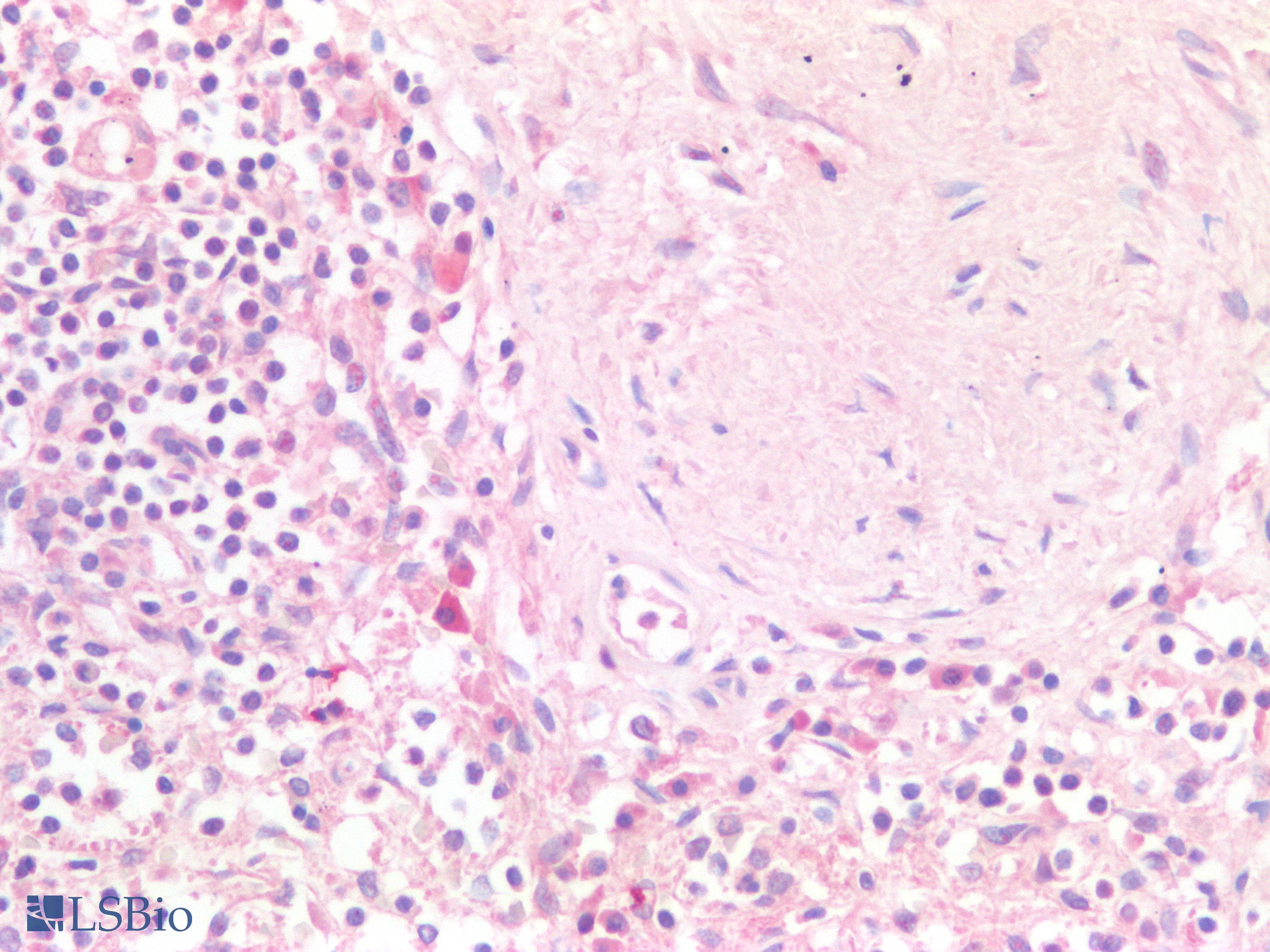 PathPlus™ POU2F2 / OCT2 Antibody