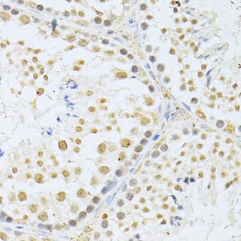 Polyclonal Rabbit anti-Human AKT1 Antibody (IHC, IF, WB)
