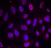 MEF2A / MEF2 Antibody