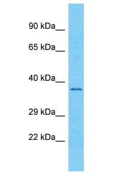 OR56A3 Antibody (aa227-276)